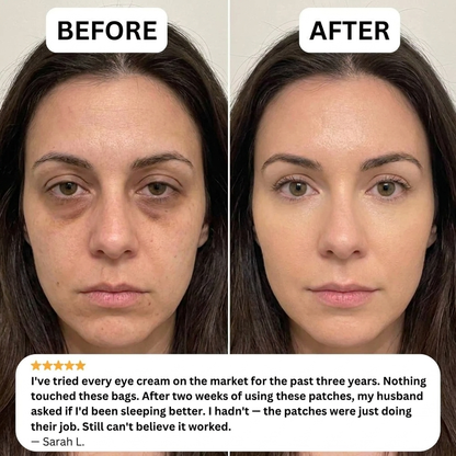 MicroGlow Under Eye Patches - NexaBeauty